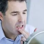 man examines his gums